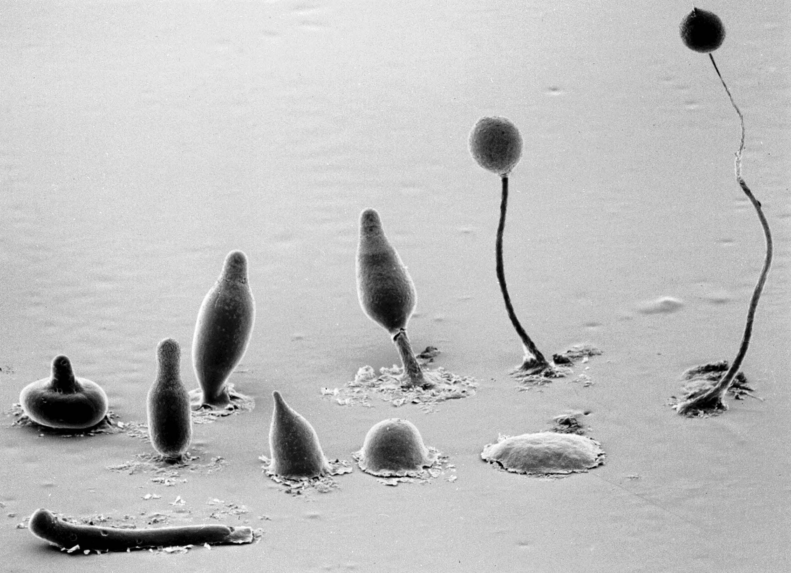 dicty-development-Credit-M.J. Grimson & R.L. Blanton. Biological Sciences Electron Microscopy Laboratory, Texas Tech University.jpg